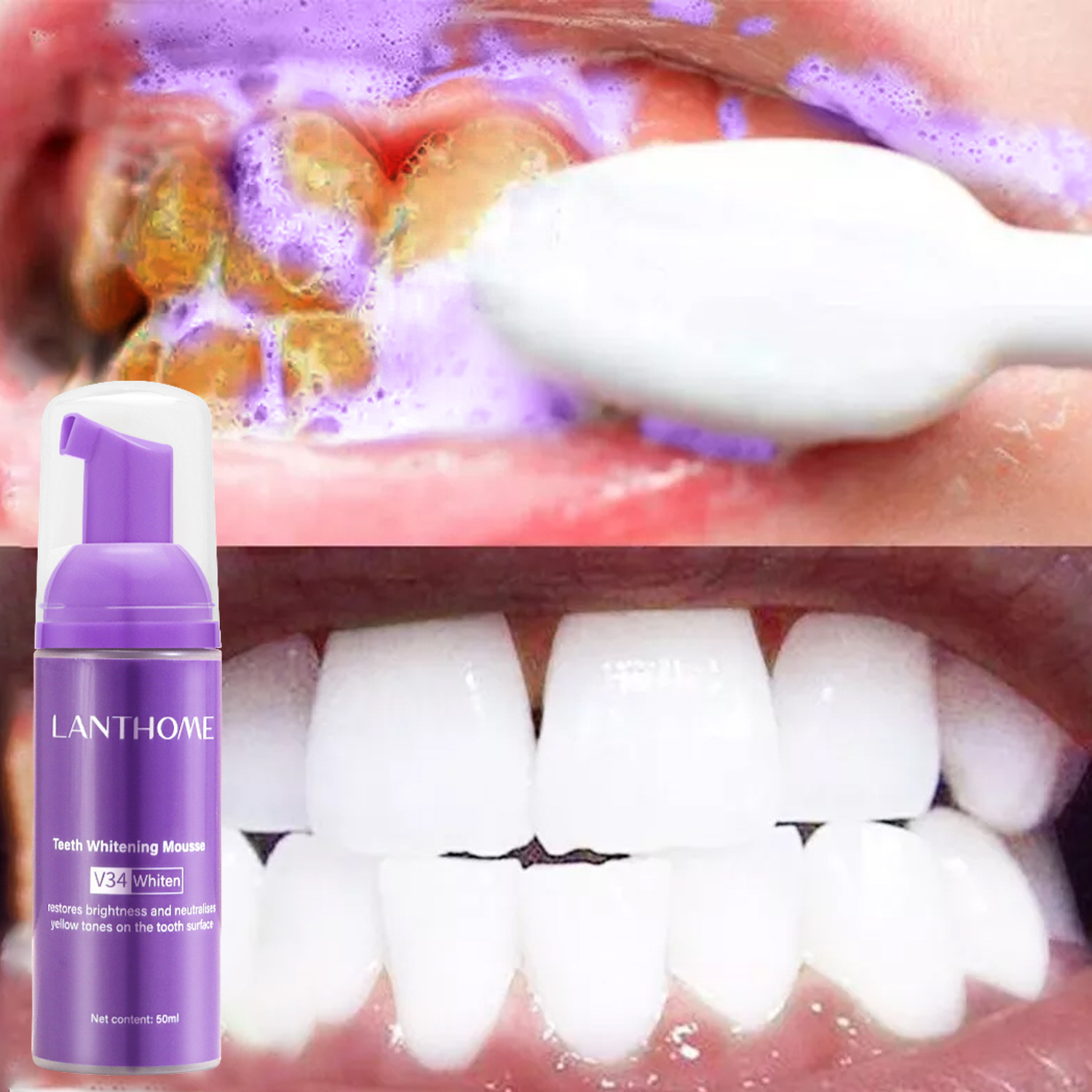 Teeth Whitening Mousse - V34 Diş Beyazlatıcı Mousse Diş Macunu