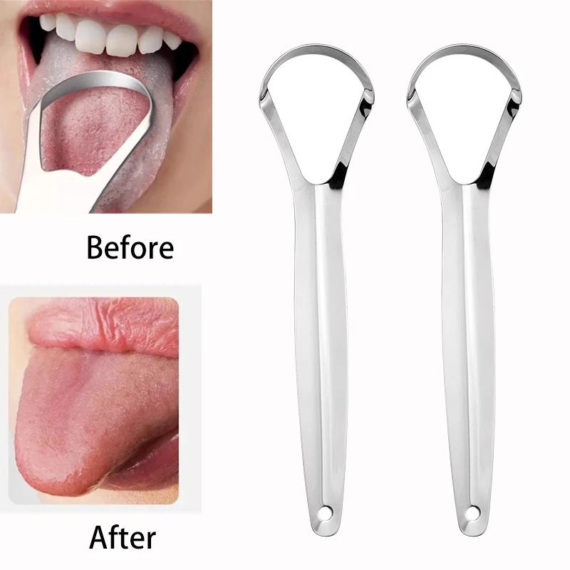 Tongue Scraper Metal - Ağız kokusu Dil Kaplama Dil Kazıyıcı
