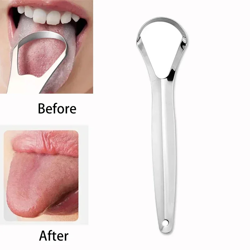 Tongue Scraper Metal - Halitosis Dil Kaplaması Dil Kazıyıcı Paslanmaz
