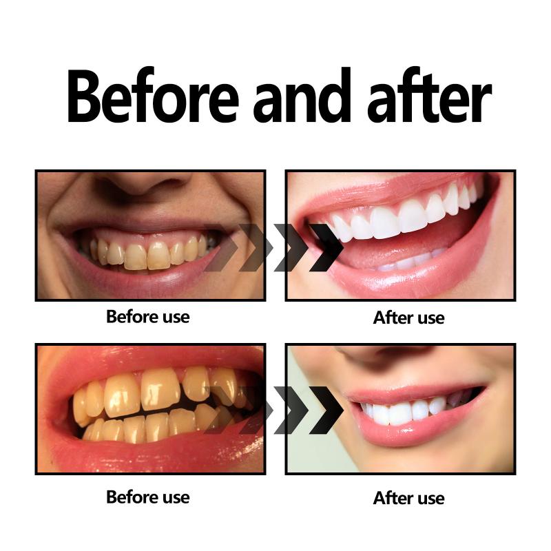 Diş Beyazlatma Tozu Kömür / Ka - Teeth Whitening Charcoal Powder incelemesi ve fiyatı