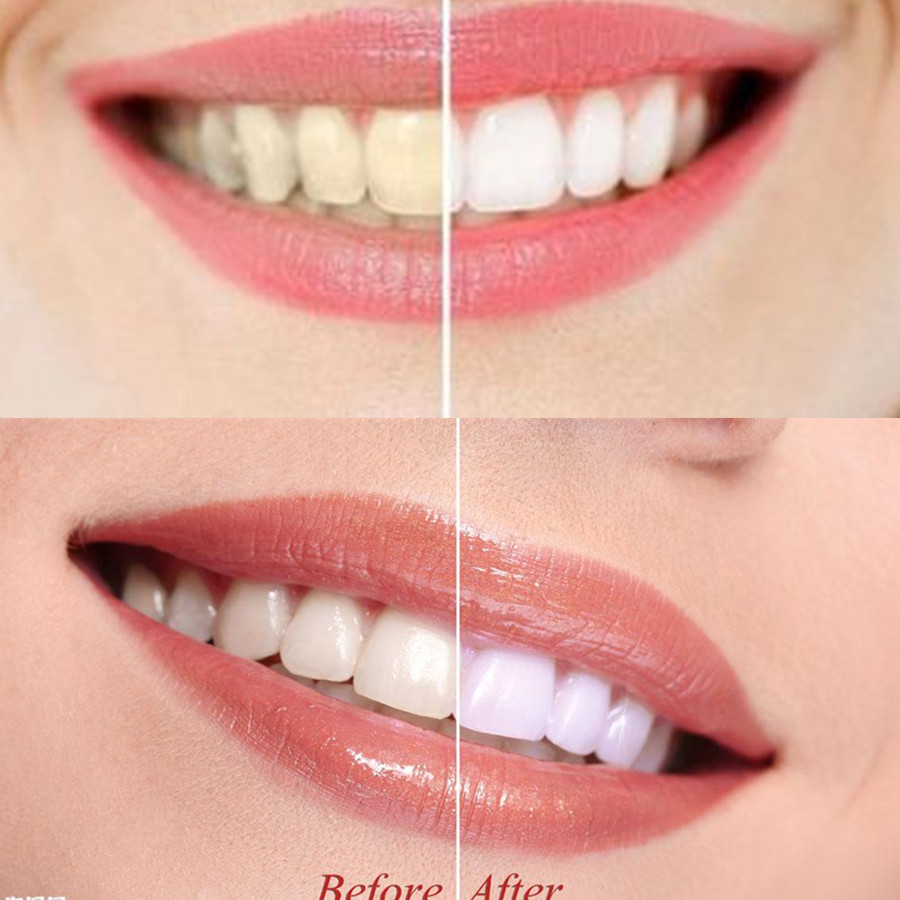 Bambu kömür diş diş diş hekimi - Teeth Whitening Charcoal Powder incelemesi ve fiyatı