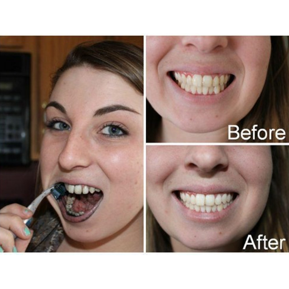 Bambu kömür diş diş diş hekimi - Teeth Whitening Charcoal Powder incelemesi ve fiyatı