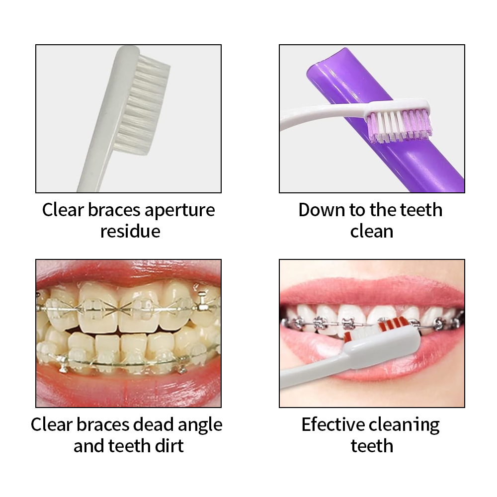 8 adet/takım ortodonti diş bak - Teeth Whitening Brush incelemesi ve fiyatı