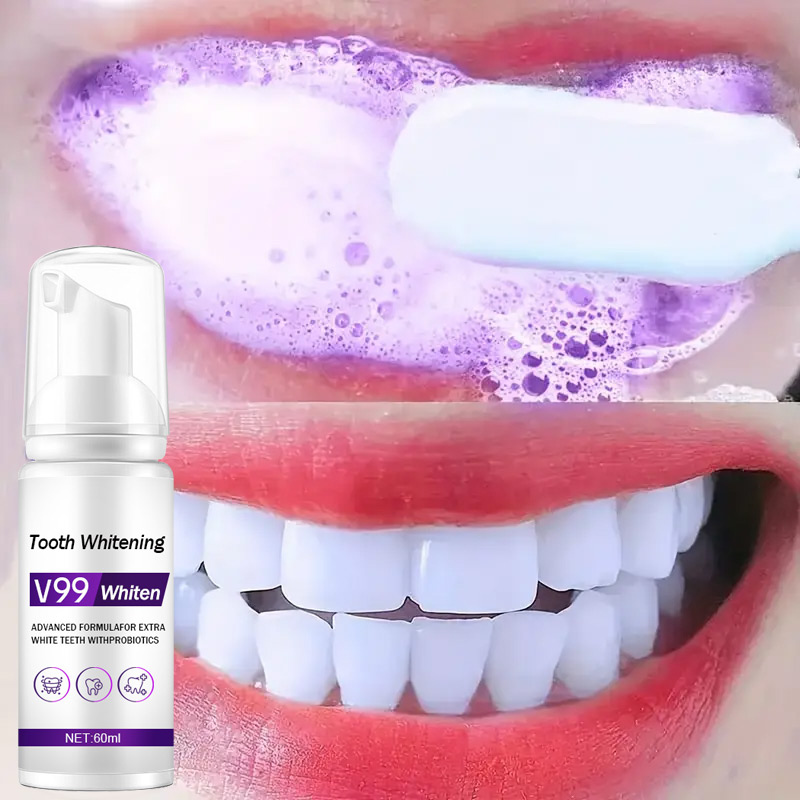 Köpük V99 Diş Macunu Diş Temiz - Teeth Whitening Mousse incelemesi ve fiyatı