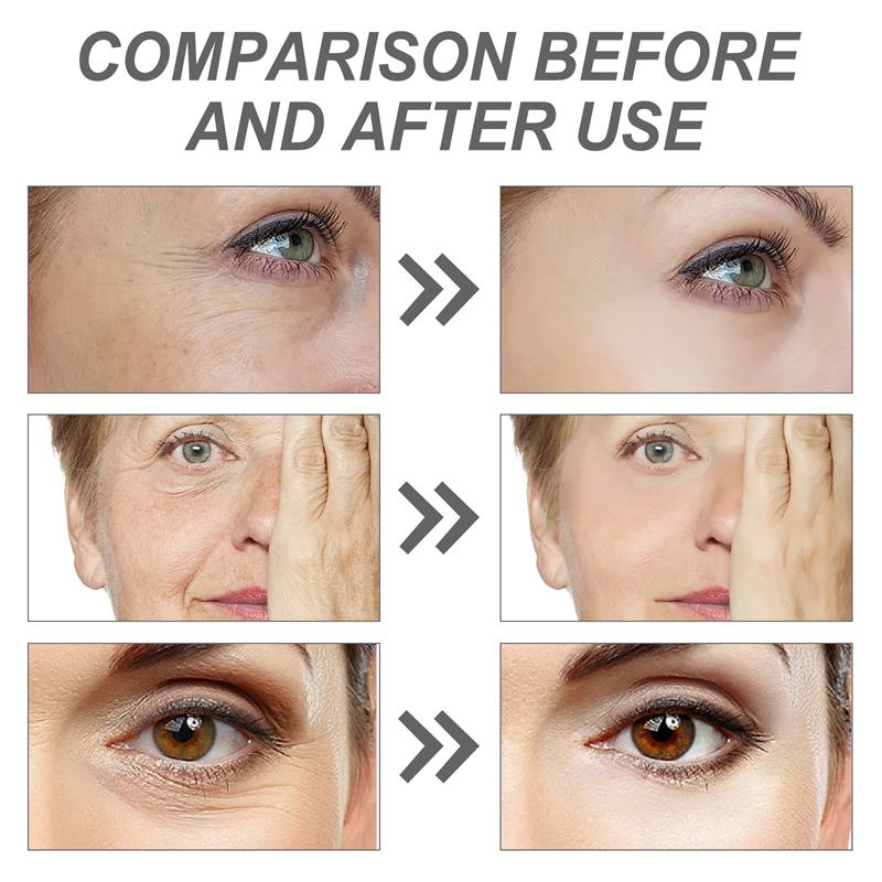 Retinol Kırışıklık Giderici Yü - The Ordinary Serum Hyaluronic Acid incelemesi ve fiyatı