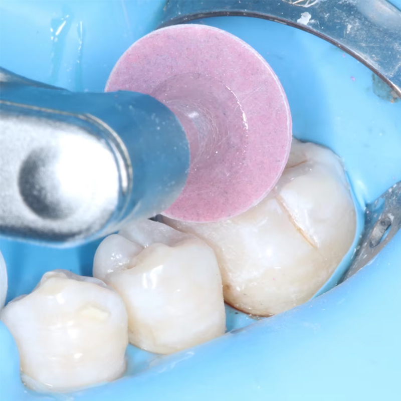 40 adet diş parlatma diski kom - Whitening Teeth Dentist incelemesi ve fiyatı