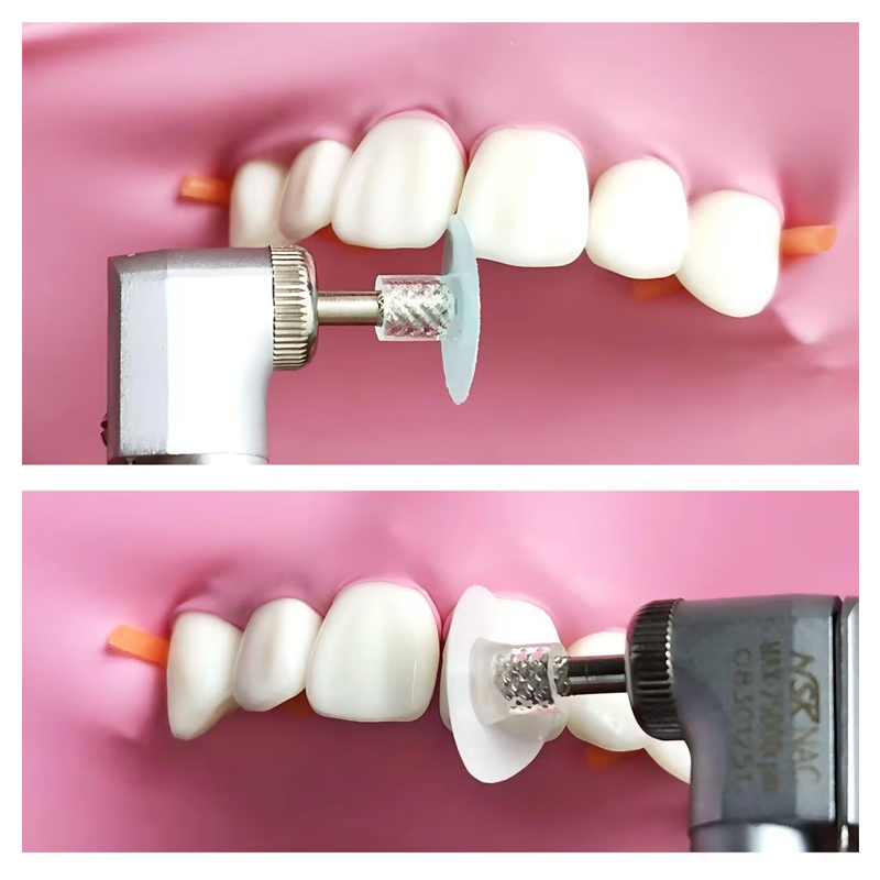40 adet diş parlatma diski kom - Whitening Teeth Dentist incelemesi ve fiyatı