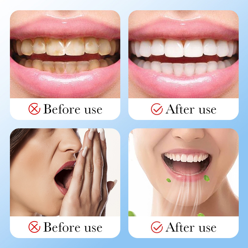 Bambu Kömürü Aktif Kömür Beyaz - Teeth Whitening Charcoal Powder incelemesi ve fiyatı