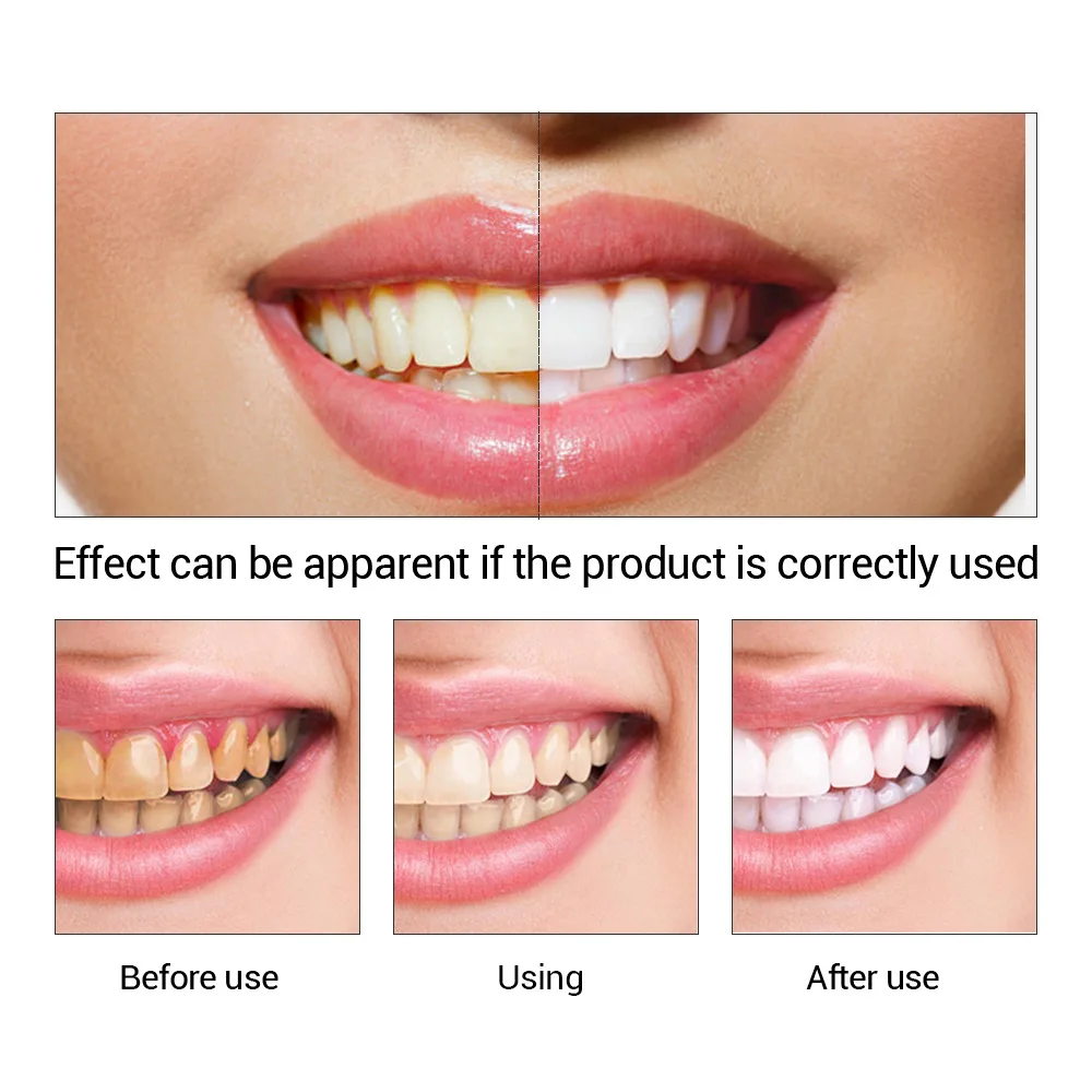 FTEENPLY diş beyazlatma özü to - Teeth Whitening Paste incelemesi ve fiyatı