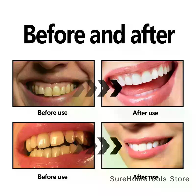 Dişler İçin Bambu Kömür Tozu D - Teeth Whitening Charcoal Powder incelemesi ve fiyatı
