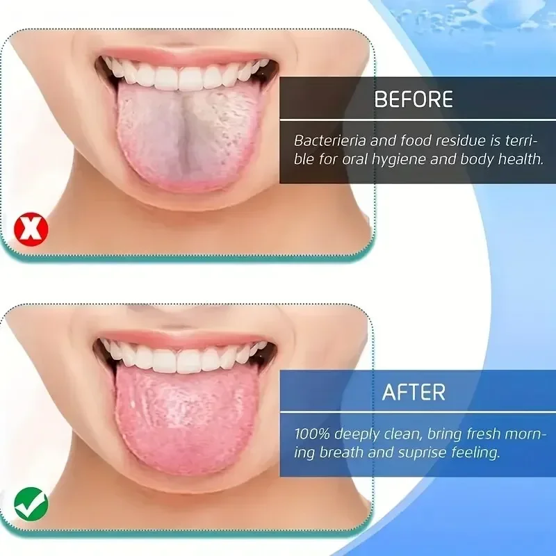 Nefes Alma Dil Kazıyıcısı Temi - Tongue Scraper Metal incelemesi ve fiyatı