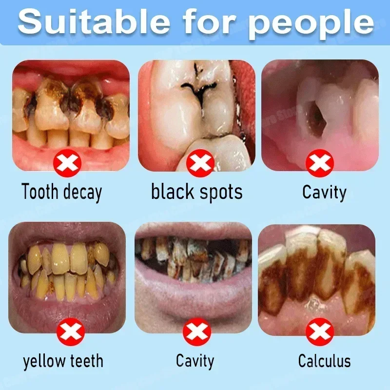 Çürük Önleyici Diş Macunu Çürü - Teeth Whitening Charcoal Powder incelemesi ve fiyatı