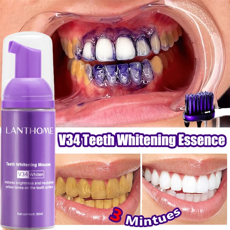 V34 Diş Beyazlatıcı Mousse Diş - Teeth Whitening Mousse incelemesi ve fiyatı