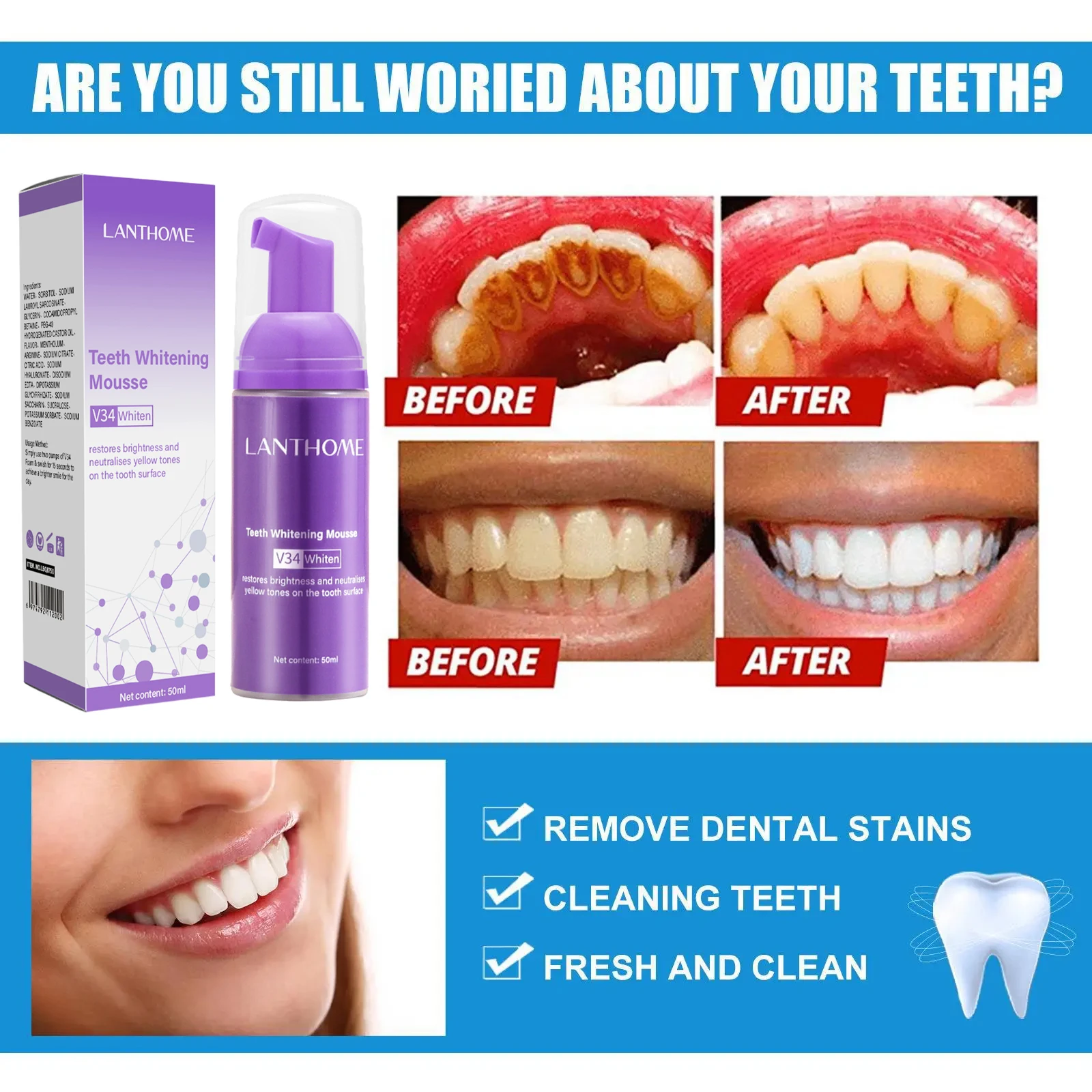 V34 Diş Beyazlatıcı Mousse Diş - Teeth Whitening Mousse incelemesi ve fiyatı