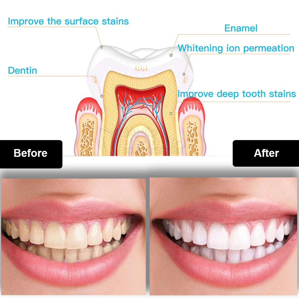 Diş Diş Beyazlatma Kiti Mini 1 - Teeth Whitening Paste incelemesi ve fiyatı