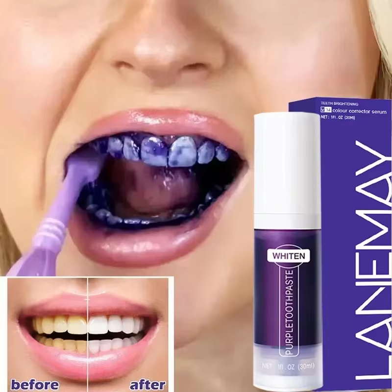 V34 Mor Diş Beyazlatma Diş Mac - Teeth Whitening Charcoal Powder incelemesi ve fiyatı