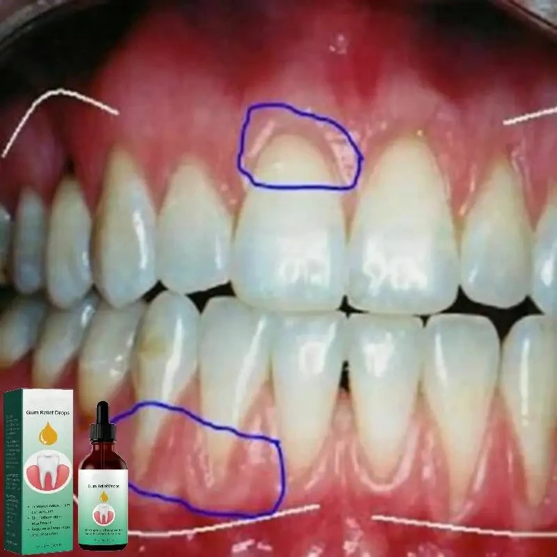 Sakız Onarım Damlaları Diş Eti - Teeth Whitening Paste incelemesi ve fiyatı