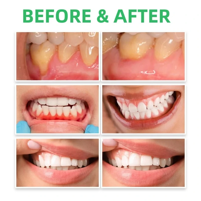 Sakız Onarım Damlaları Diş Eti - Teeth Whitening Paste incelemesi ve fiyatı
