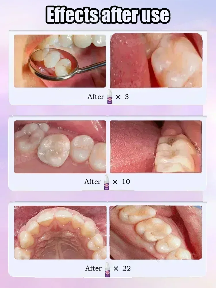 Diş Temizleme Diş Macunu Diş L - Teeth Whitening Toothpaste incelemesi ve fiyatı