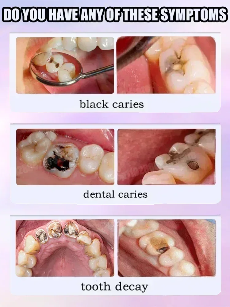 Diş Temizleme Diş Macunu Diş L - Teeth Whitening Toothpaste incelemesi ve fiyatı